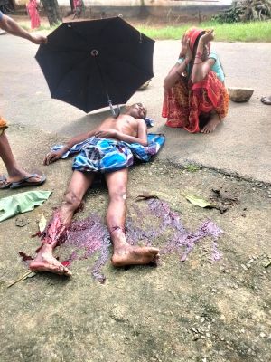  दमगड़ा में रफ्तार का कहर: कोटिया-रमसमा मार्ग पर तेज बाइक ने बुजुर्ग को मारी जोरदार टक्कर, दोनों पैर और एक हाथ में गंभीर चोट, बाइक सवार दोनो युवक भी गंभीर रूप से घायल
